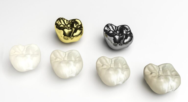how to avoid dental crowns if you do not really need them