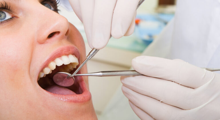 routine vs deep dental cleanings