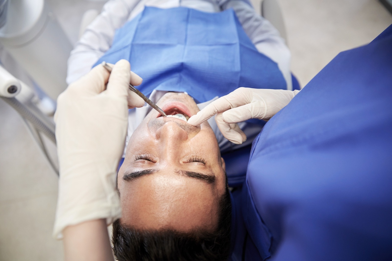 these signs may indicate you require a deep dental cleaning