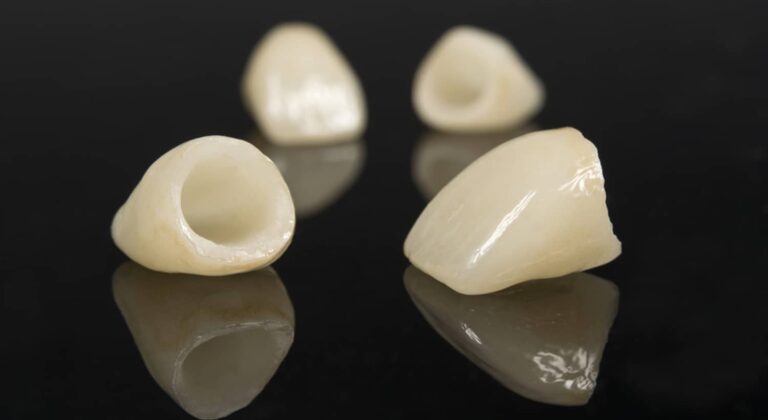 how to choose the most natural looking dental crowns