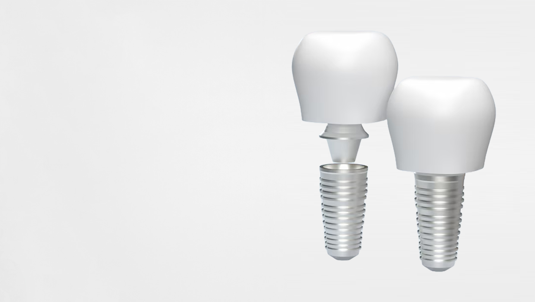 long term tooth replacement option
